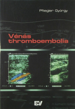 Vns thromboembolia