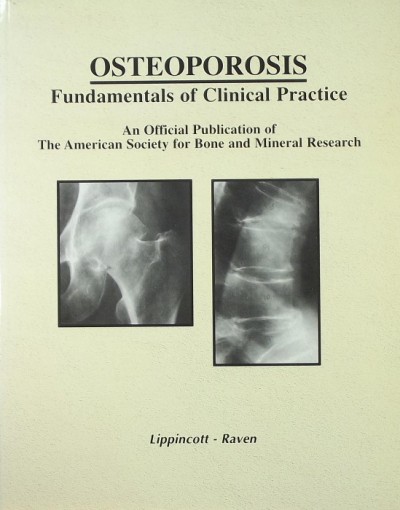 - Osteoporosis