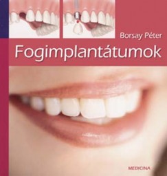 Dr. Borsay Pter - Fogimplanttum - Korunk szenzcija
