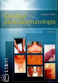 Dr. Horkay Irn - Klinikai photodermatologia