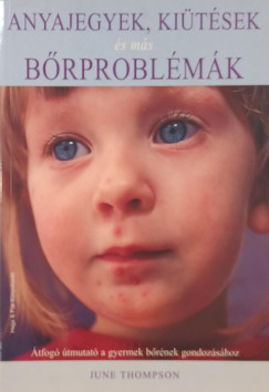 June Thomson - Anyajegyek, ki�t�sek �s m�s b�rprobl�m�k