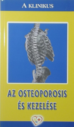 Az osteoporosis s kezelse