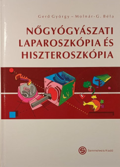 Dr. Gerő György - Dr Molnár Béla - Nőgyógyászati laparoszkópia és hiszteroszkópia