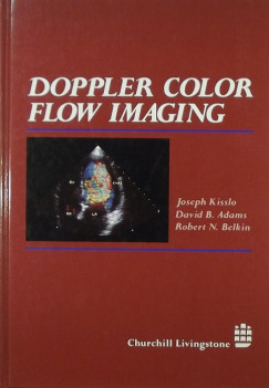David B. Adams - Robert N. Belkin - Joseph Kisslo - Dopper Color Flow Imaging