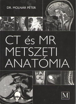 CT s MR metszeti anatmia