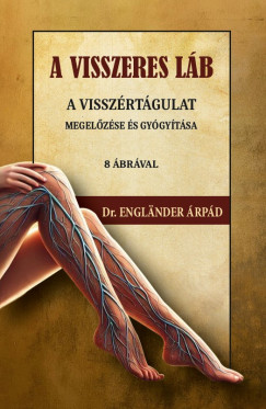 A visszeres lb a visszrtgulat megelzse s gygytsa