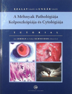 A Mhnyak Patholgija Kolposzkpija s Cytolgija