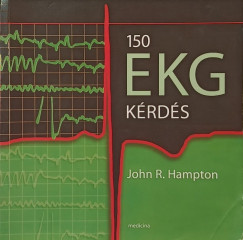 150 EKG k�rd�s