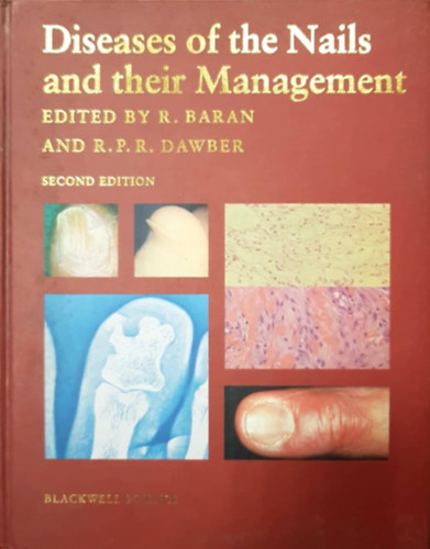 R.P.R. Dawber R. Baran - Diseases of the Nails and their Management