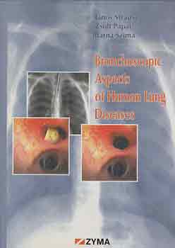 Strausz-Pápai-Szima - Bronchoscopic Aspects of the Human Lung Diseases