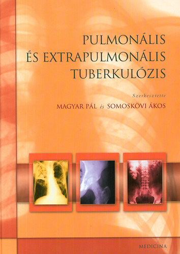 Pulmonális és extrapulmonális tuberkulózis