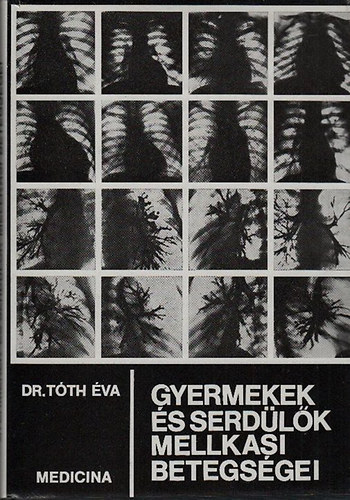 Dr. Tth va - Gyermekek s serdlk mellkasi betegsgei