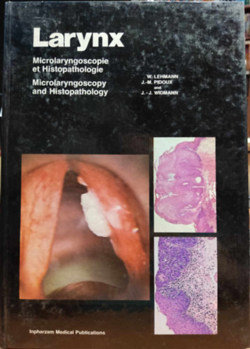 Larynx - Microlaryngoscopie et Histopathologie