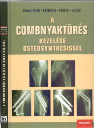 Szerkesztette: Manninger Jen� - Cserh�ti P�ter - Fekete K�roly - Kaz�r Gy�rgy - A combnyakt�r�s kezel�se osteosynthesissel (Dedik�lt)