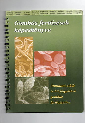 Dr.Pod�nyi Be�ta - Gomb�s fert�z�sek k�pesk�nyve