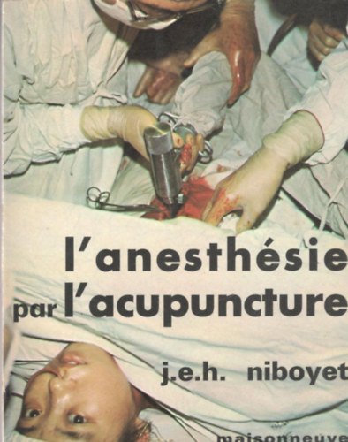 J.E.H. Niboyet - L'anesthésie par l'acupuncture