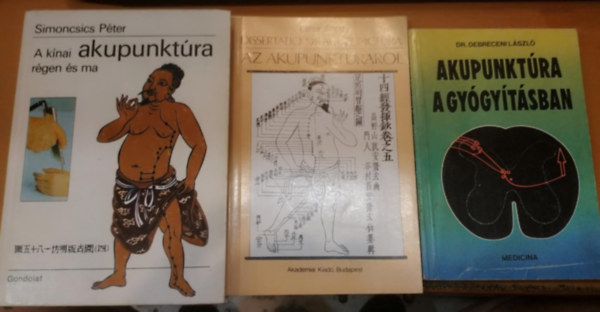 Dr. Laner Antal, Dr. Simoncsics Péter Debreceni László - 3 db Akupunktúra a gyógyításban + Dissertatio de acupunctura az akupunktúráról + A kínai akupunktúra régen és ma