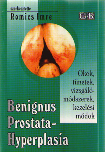 Romics Imre  (szerk.) - Benignus prostatahyperplasia