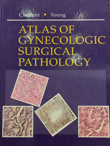 Young Clement - Atlas of Gynecologic Surgical Pathology