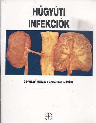 Húgyúti infekciók