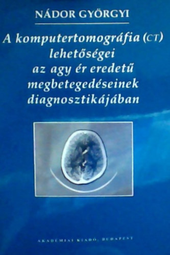 N�dor Gy�rgyi - A komputertomogr�fia (CT) lehet�s�gei az agy �r eredet� megbeteged�seinek diagnosztik�j�ban