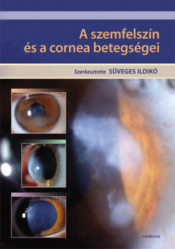 S�veges Ildik� - A szemfelsz�n �s a cornea betegs�gei