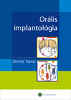 Divinyi Tams  (szerk.) - Orlis implantolgia