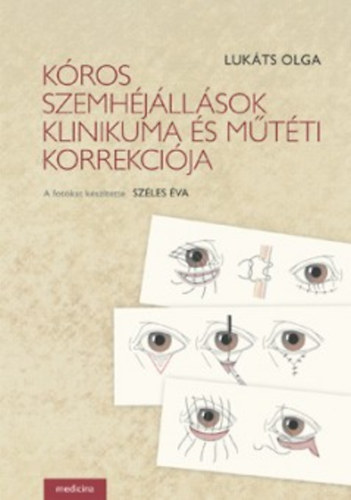Lukáts Olga - Kóros szemhéjállások klinikuma és műtéti korrekciója