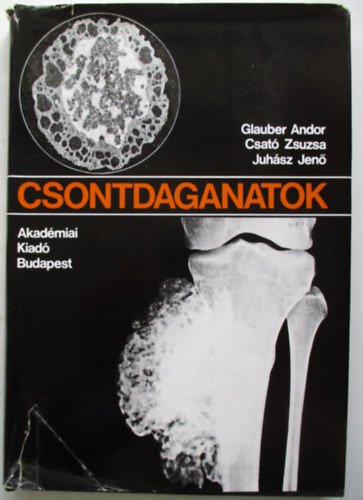 Glauber Andor; Csat� Zsuzsa; Juh�sz Jen� - Csontdaganatok