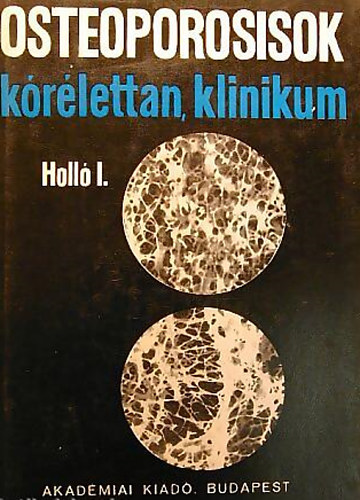 Dr. Holl� Istv�n - Osteoporosisok - K�r�lettan, klinikum