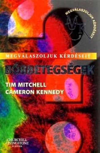 Tim Mitchell Cameron Kennedy - B�rbetegs�gek - Megv�laszoljuk k�rd�seit