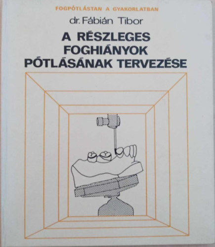 Dr. Fbin Tibor GRAFIKUS Vrbel Ferenc - A rszleges foghinyok ptlsnak tervezse - Fogptlstan a gyakorlatban