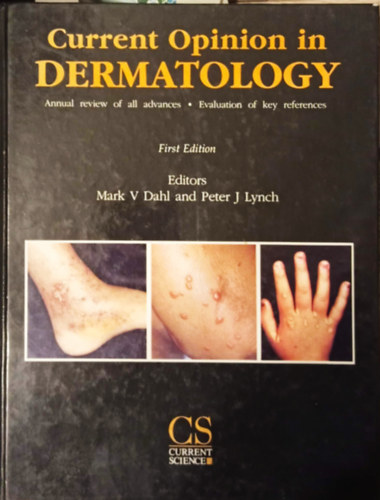 Mark V Dahl - Current Opinion in Dermatology