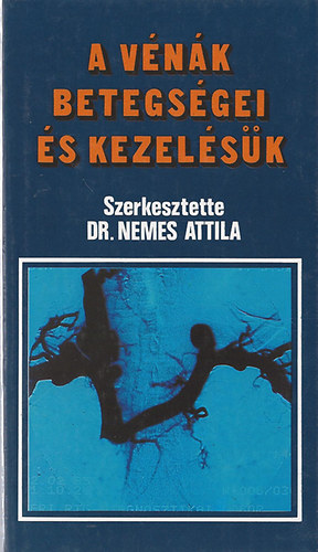 Dr.Nemes Attila - A vénák betegségei és kezelésük