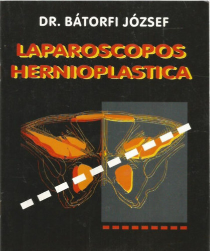 Dr. B�torfi J�zsef - Laparoscopos Hernioplastica