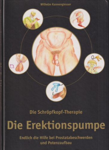 Wilhelm Kannengiesser - Die Schr�pfkopt-Therapie: Die Erektionspumpe