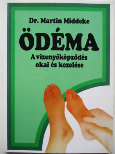 Midekke, Martin - Ödéma - A vizenyőképződés okai és kezelése