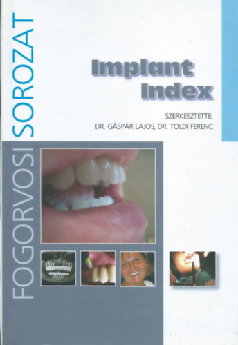 Dr. Gspr Lajos - Dr. Toldi Ferenc - Implant Index (Fogorvosi sorozat)