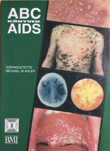 Michael  W Adler - ABC K�nyvek AIDS