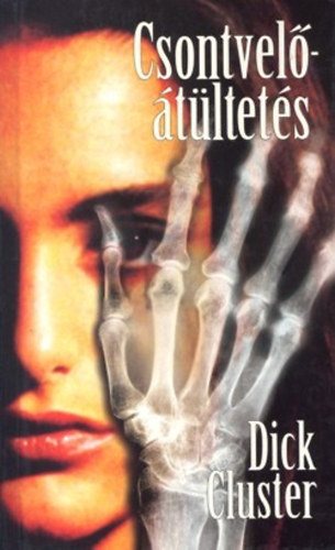 Dick Cluster - Csontveltltets