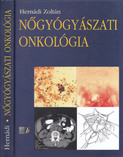 Herndi Zoltn - Ngygyszati onkolgia