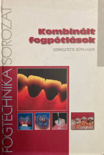 R�th Lajos - Kombin�lt fogp�tl�sok