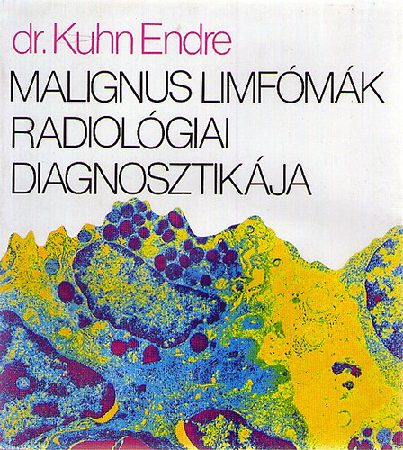 Dr. Kuhn Endre - Malignus limfómák radiológiai diagnosztikája