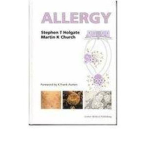 Stephen T. Holgate - Martin K. Church - Allergy (Allergia - angol nyelv�)