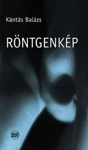 Kántás Balázs - Röntgenkép