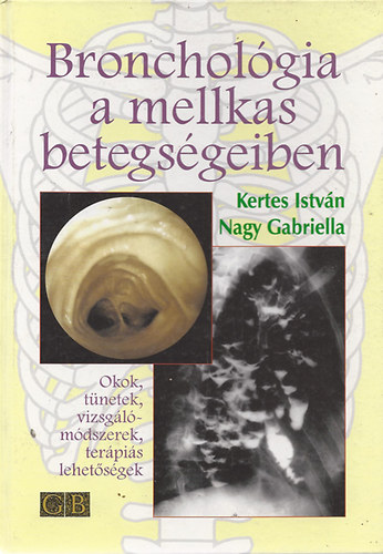 Kertes Istvn; Nagy Gabriella - Broncholgia a mellkas betegsgeiben