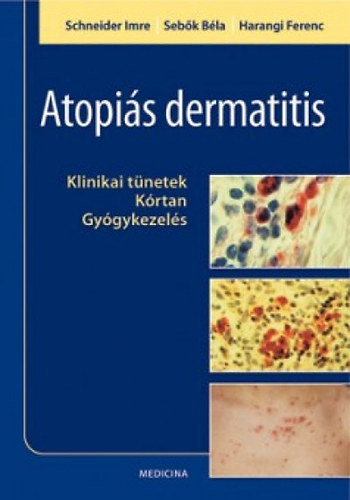 Harangi Ferenc; Schneider Imre; Sebk Bla - Atopis dermatitis