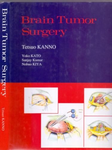Sanjay Kumar, Yoko Kato, Nobuo Kiya Tetsuo Kanno - Surgical Techniques in Brain Tumor Surgery (Neurosurgery)