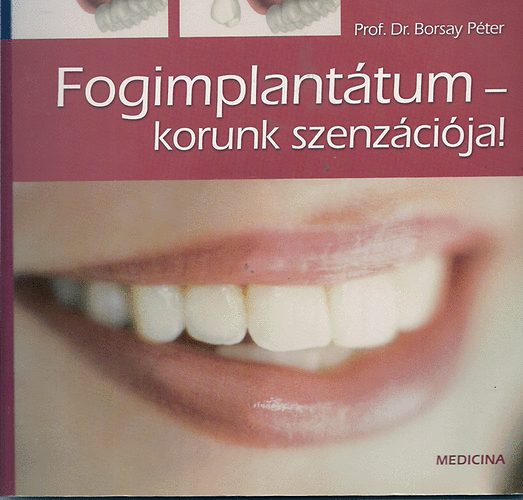 Prof. Dr. Borsay P�ter - Fogimplant�tum-korunk szenz�ci�ja!