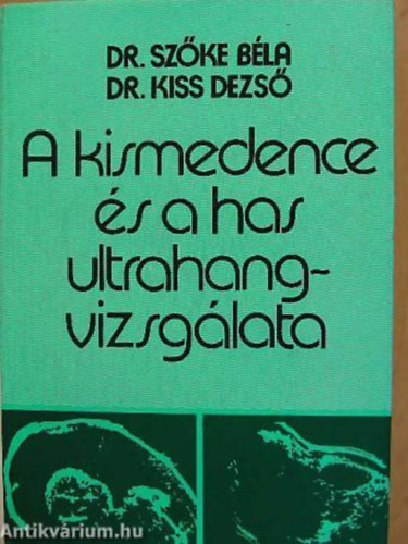 Kiss Dezső dr. Szőke Béla dr. - A kismedence és a has ultrahangvizsgálata